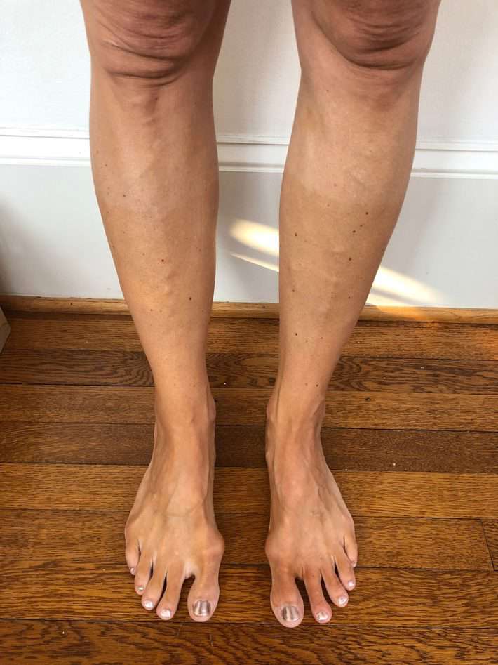 woman legs using self tanner