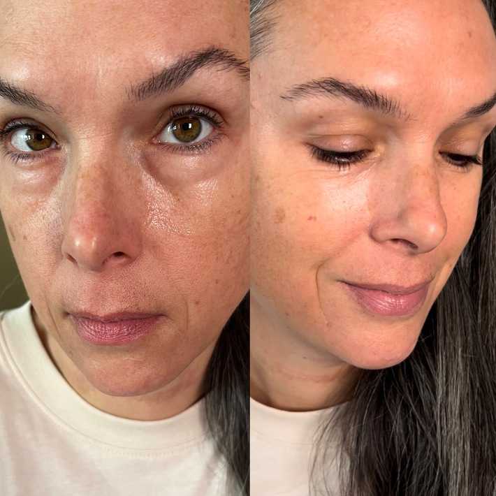before and after using 100% pure bright eyes masks