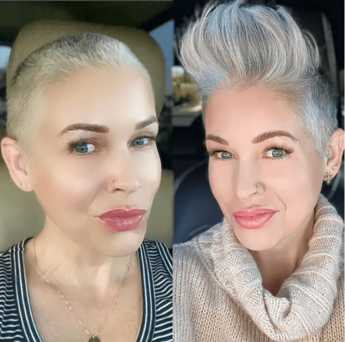 side by side photos of a woman growing out a pixie hair cut